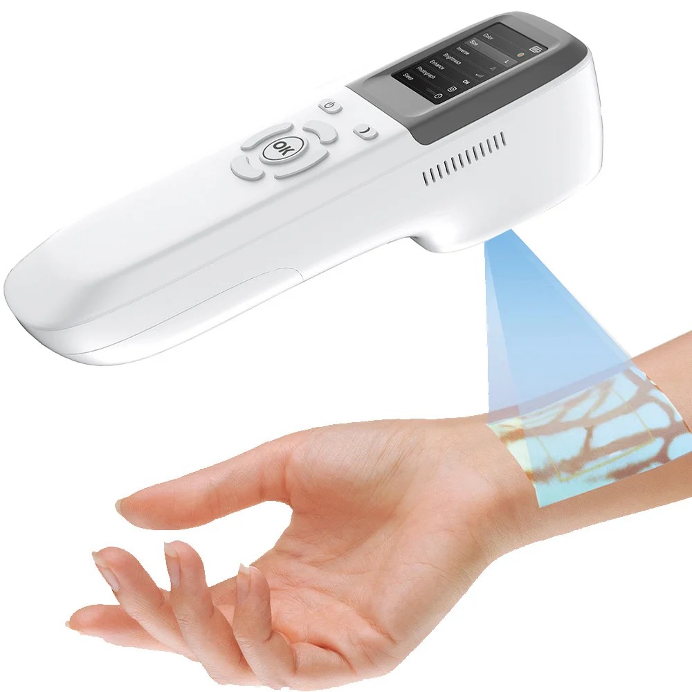 كاشف الأوردة (Vein Finder)